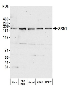 Rabbit anti-XRN1 Antibody