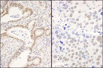 Rabbit anti-CCAR1 Antibody