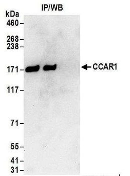 Rabbit anti-CCAR1 Antibody