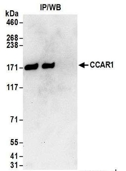 CCAR1 Antibody