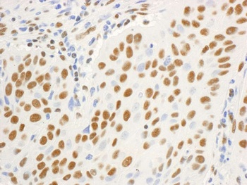 Rabbit anti-DBC1/p30 DBC Antibody