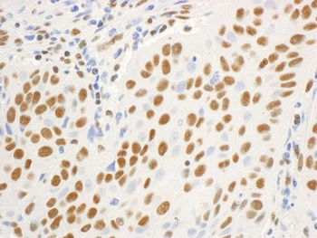 DBC1/p30 DBC Antibody