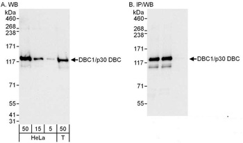 Rabbit anti-DBC1/p30 DBC Antibody