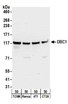 Rabbit anti-DBC1/p30 DBC Antibody