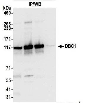 DBC1/p30 DBC Antibody