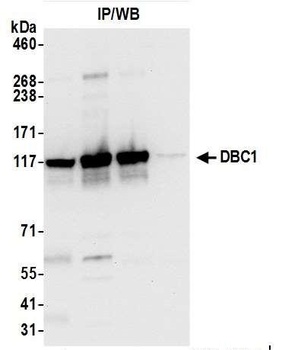 Rabbit anti-DBC1/p30 DBC Antibody