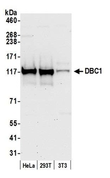Rabbit anti-DBC1/p30 DBC Antibody