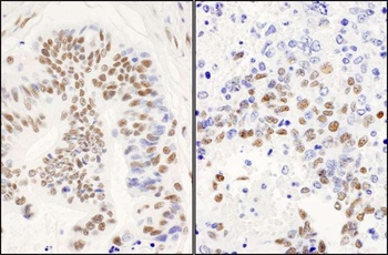 Rabbit anti-DBC1/p30 DBC Antibody