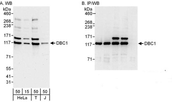 Rabbit anti-DBC1/p30 DBC Antibody