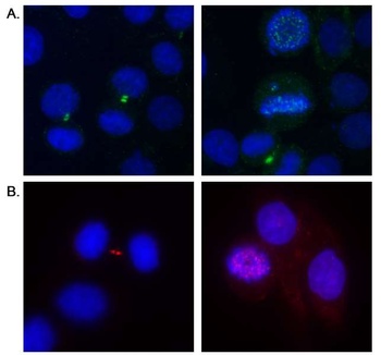 Rabbit Aurora B Antibody