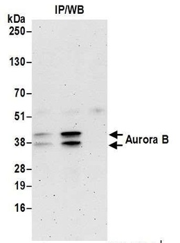 Rabbit Aurora B Antibody