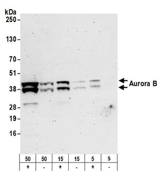Rabbit Aurora B Antibody