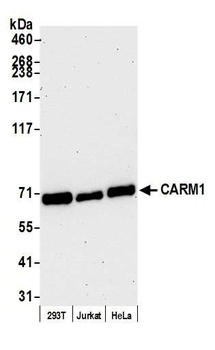 Rabbit anti-CARM1 Antibody