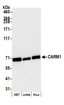 CARM1 Antibody