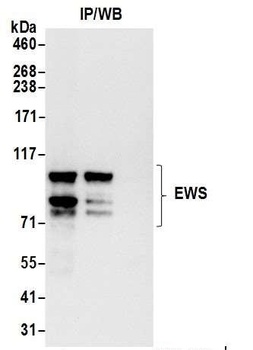 Rabbit EWS Antibody