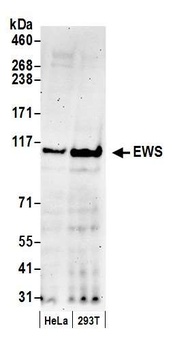 Rabbit EWS Antibody