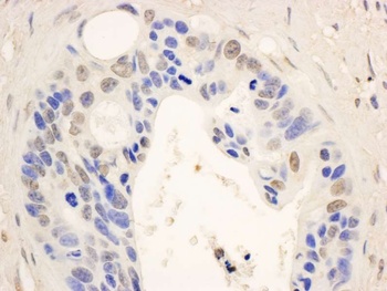 Rabbit anti-STAT6 Antibody