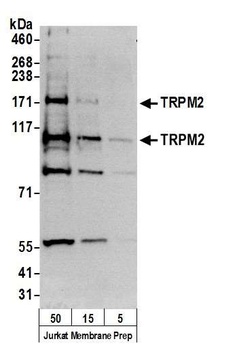 Rabbit TRPM2 Antibody