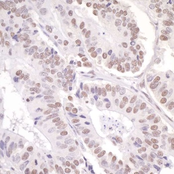Rabbit anti-ASC2 Antibody