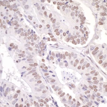 ASC2 Antibody