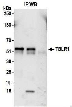 TBLR1 Antibody