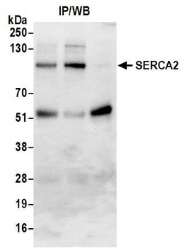 Rabbit SERCA2 Antibody