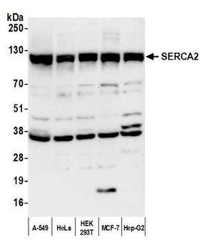 Rabbit SERCA2 Antibody