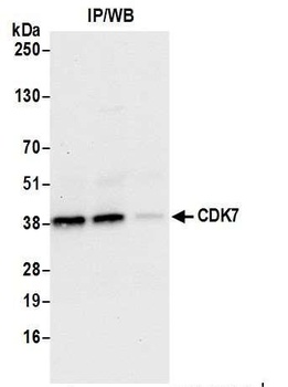 Rabbit CDK7 Antibody
