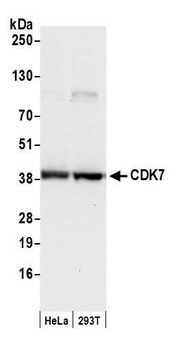 Rabbit CDK7 Antibody