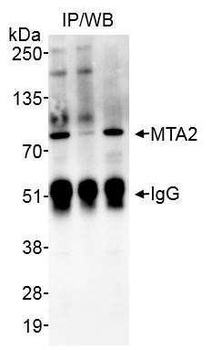 Rabbit anti-MTA2 Antibody