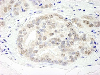 Rabbit anti-DHX15 Antibody