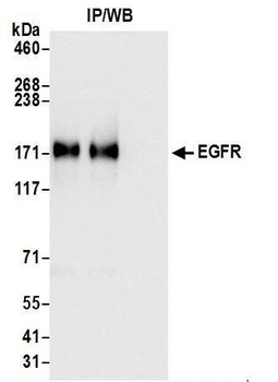 Rabbit anti-EGFR Antibody