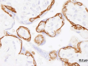 Rabbit anti-EGFR Antibody