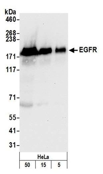 Rabbit anti-EGFR Antibody