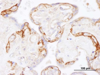 Rabbit anti-EGFR Antibody