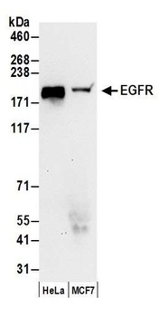 Rabbit anti-EGFR Antibody