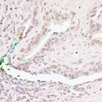Rabbit anti-Bcl11b Antibody