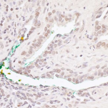 Bcl11b Antibody