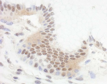 Rabbit anti-Bcl11b Antibody