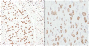 Rabbit CA150 Antibody