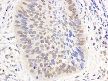Rabbit anti-p300 Antibody