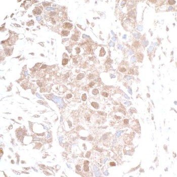 Rabbit anti-p300 Antibody