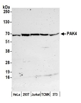 Rabbit anti-PAK4 Antibody