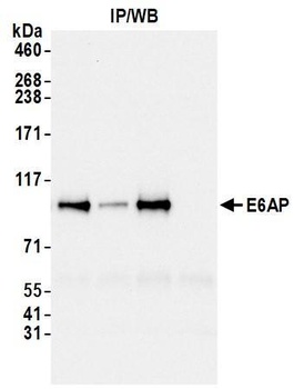 Rabbit anti-E6AP Antibody