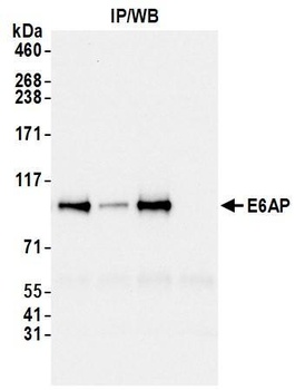 E6AP Antibody