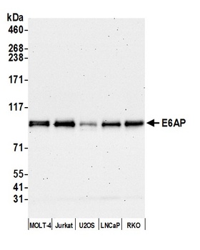 E6AP Antibody