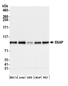 Rabbit anti-E6AP Antibody
