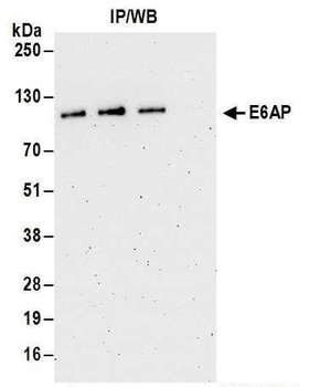 E6AP Antibody