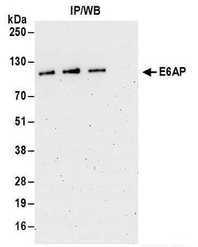 Rabbit anti-E6AP Antibody