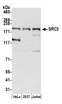 Rabbit SRC3 Antibody